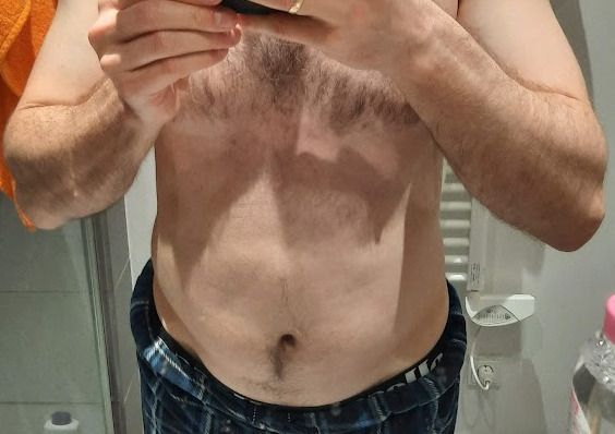 Belly in January 2025